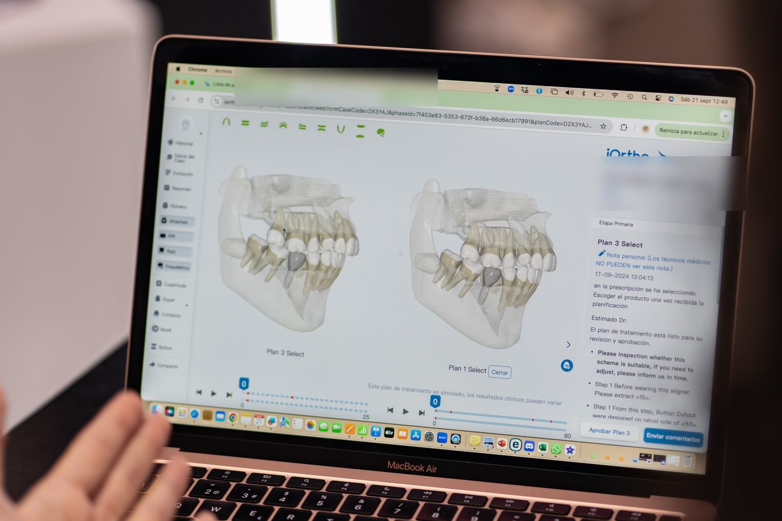 Formación en ortodoncia — planificación digital